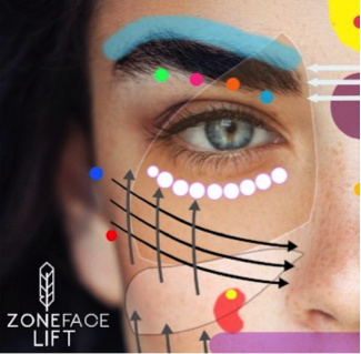 Zone face lift